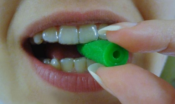 Aparelho Dentário Transparente Caxingui - Aparelho Invisalign Transparente