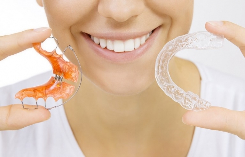 Aparelho Invisalign Ortodôntico Jardim Ademar - Aparelho Autoligado Invisalign