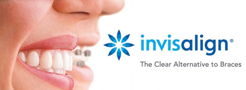 Aparelho Invisalign Transparente Jardim Taboão - Invisalign Dentista