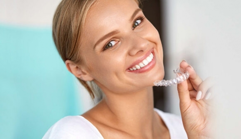 Aparelho Autoligado Invisalign - Ideal Odonto Style