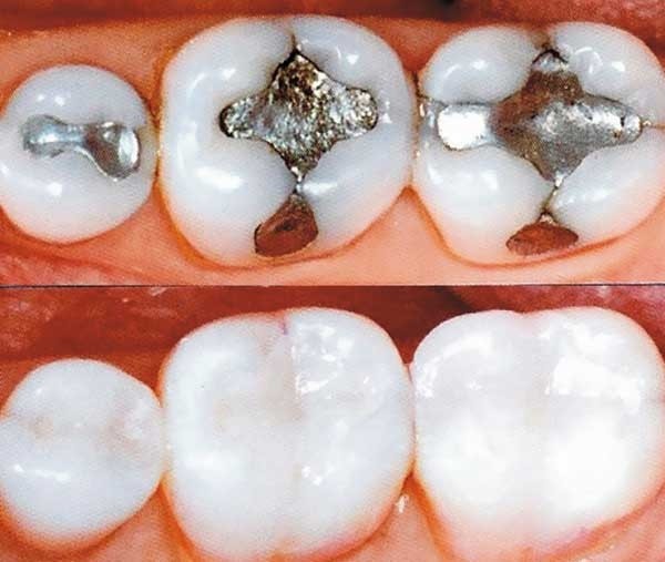 Assistência Odontológica Preço na Vila Alteza - Clínica de Odontologia