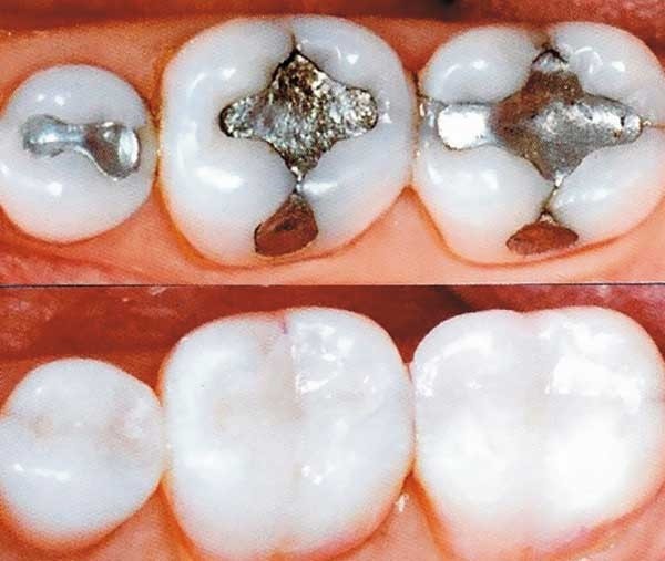 Assistência Odontológica Preço no Conjunto Residencial Prestes Maia - Clínica Ortodôntica