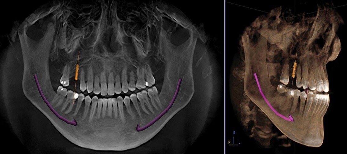 Centro de Radiologia Odontológica no Conjunto Residencial Prestes Maia - Centro de Especialidade Odontológica