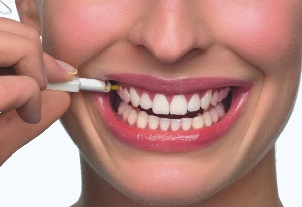 Clínica com Tratamento Dentario a Laser Vila Cercado Grande - Clínica de Tratamento Dentário