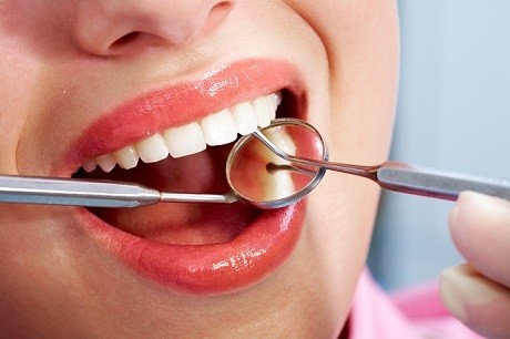 Clínica com Tratamento Dentário de Canal no Jardim Duprat - Clínica de Tratamento Dentário