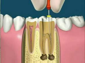 Clínica com Tratamento Dentário e Resina no Jardim Maria Virginia - Clínica de Tratamento Dentário