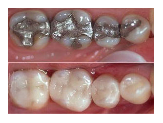 Clínica de Atendimento de Dentário no Conjunto Residencial Prestes Maia - Clínica de Dentista