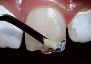 Clínica de Dentista Especialista em Implante na Vila Gomes - Dentista 24 Hs
