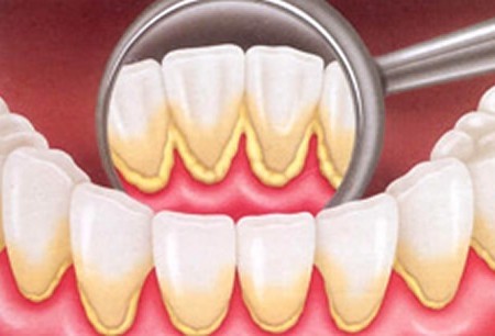 Clínica de Periodontia Preço na Vila América - Diagnóstico em Periodontia