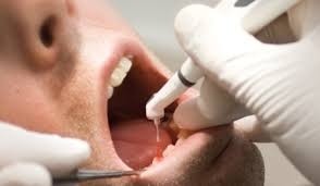 Clínica de Tratamento Dentário no Jardim Duprat - Clínica de Tratamento Dentário