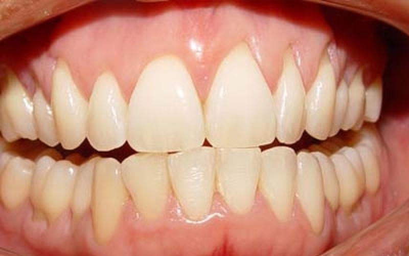 Clínica Especializada em Periodontia no Jardim Rizzo - Clínica de Periodontia