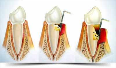 Clínica Odontológica Onde Encontrar no Conjunto Residencial Morumbi - Assistência Odontológica