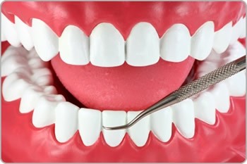 Clínicas de Periodontia Preço Embu Guaçu - Dentista Periodontista