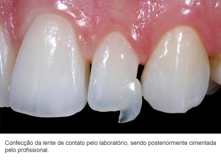 Consulta com Dentista Valor no Jardim Ingá - Dentista Especialista em Estética