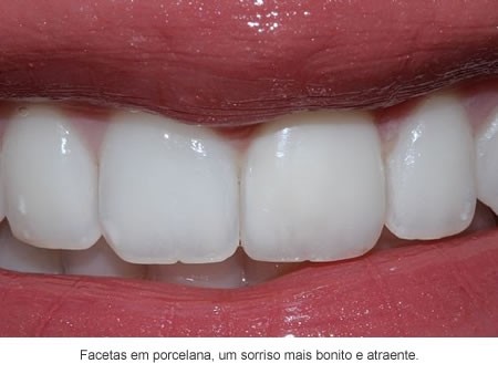 Dentista 24 Hs na Vila Brasil - Dentista 24 Hs
