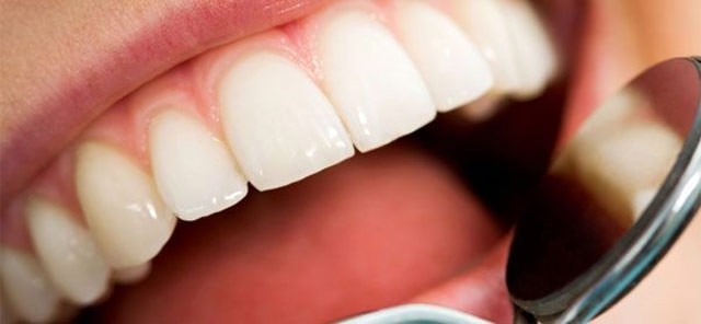 Dentista Especialista em Periodontia na Vila Olga - Periodontia em Embu das Artes