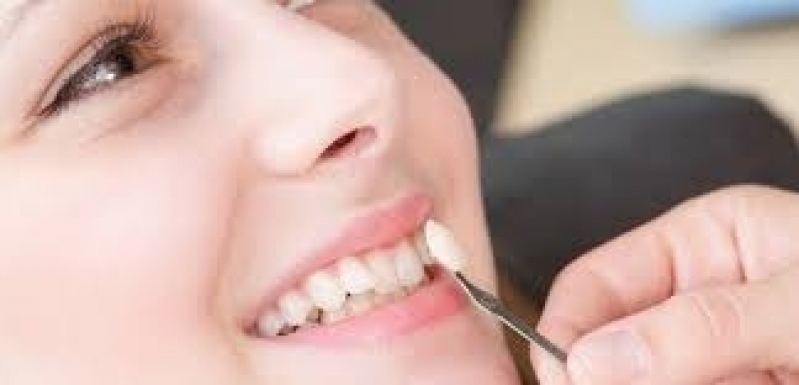 Lente Dental de Porcelana Jardim São Gilberto - Lente de Contato para Os Dentes