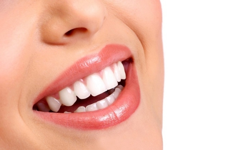 Lentes de Contato Dental Jardim Duprat - Lente Dental de Porcelana