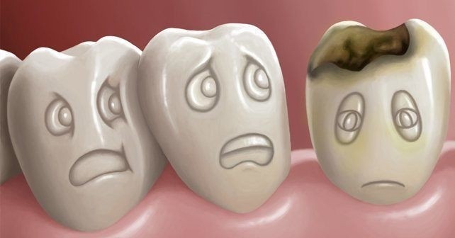 Odontologia Estética Valores Quinhaú - Centro de Especialidade Odontológica