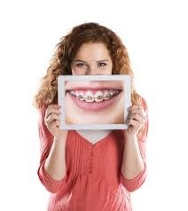 Onde Encontrar Aparelho Dentário em Taboão da Serra no Jardim Mitsutani - Clínica de Aparelhos Dentários
