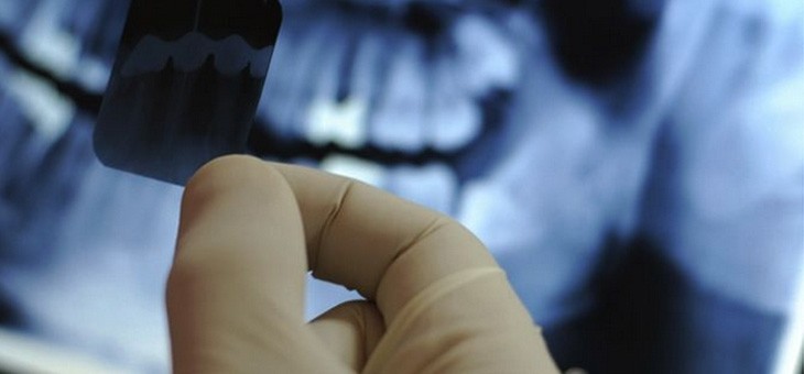 Onde Encontrar Centro de Radiologia Odontológica no Jardim Paris - Centro de Especialidade Odontológica