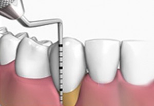 Onde Encontrar Clínica de Periodontia no Jardim Rebouças - Periodontia em Sp