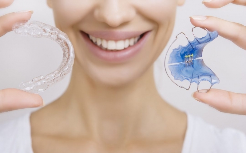 Onde Encontro Aparelho Transparente Invisalign Jardim Catanduva - Invisalign Dentista