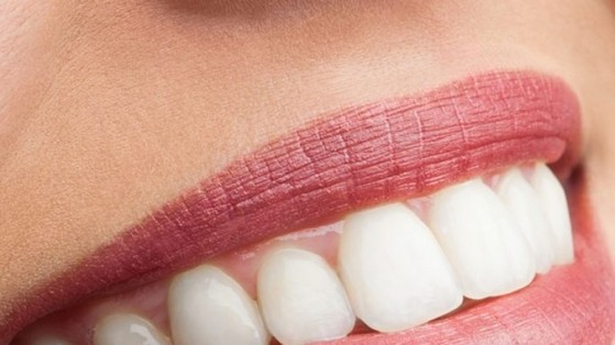 Onde Encontro Lente de Contato para Dentes Tortos Vila Franca - Clínica para Lentes de Contato Dental