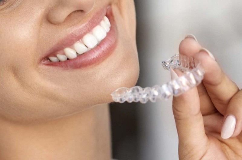 Quanto Custa Aparelho Transparente Dental Embu das Artes - Aparelho Transparente Móvel