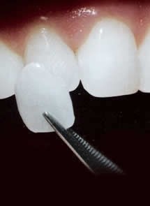 Quanto Custa Clínica para Tratamentos Dentários no Conjunto Residencial Morumbi - Tratamento Dentário em Sp