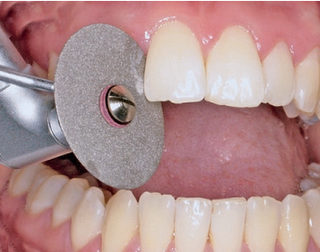 Quanto Custa Tratamento Dentário Rápido no Jardim Novo Oriente - Tratamento Dentário Rápido