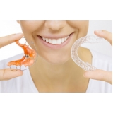 Aparelho Invisalign Ortodôntico