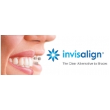 aparelho invisalign transparente Rolinópolis