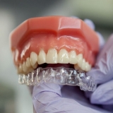 aparelho transparente dental Chácara do Bom Conselho