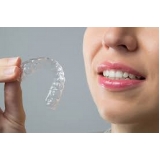 aparelho transparente dentário Rolinópolis