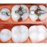 assistência odontológica preço na Vila Carioca