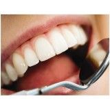clínica com tratamento dentário e restauração no Jardim Maria Sampaio