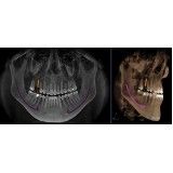 clínica de especialidade odontológica preço no Jardim Piracuama