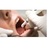 clínica de tratamento dentário Embu-Mirim