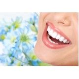 clínica estética dental na Vila Franca