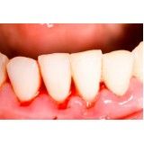 consultório de periodontia preço no Jardim Nelma