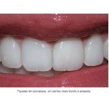 dentista 24 hs no Jardim Nelma