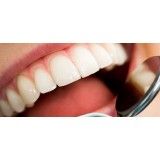 dentista especialista em periodontia na Vila Alteza