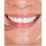 dentista especialista no Jardim Mitsutani