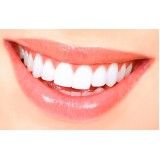 dentista especializado em prótese na Vila Pirajussara