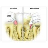 dentista periodontia no Jardim São Januário