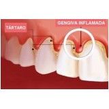 especialista em periodontia na Cidade Universitária