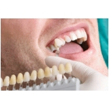 lente de contato para dentes Embu-Mirim