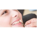 lente dental de porcelana Jardim Esmeralda
