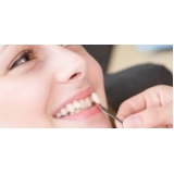 lente dental de porcelana Jardim Samara